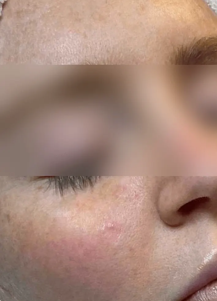 Before and after result 1 — before