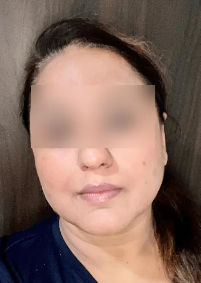 Before and after result 2 — after