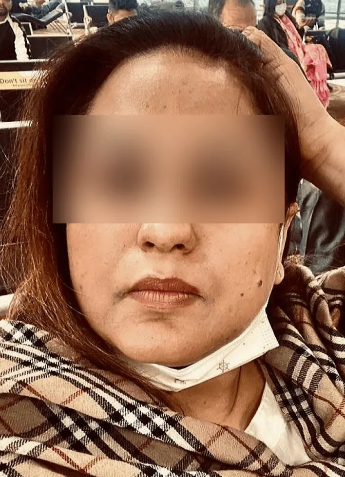 Before and after result 2 — before
