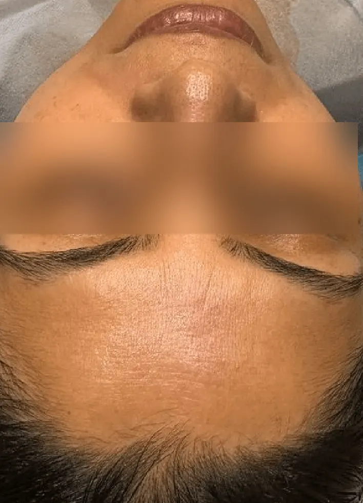 Before and after result 3 — after