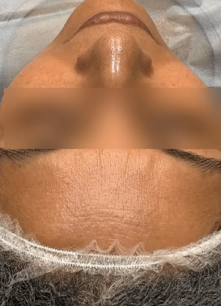 Before and after result 3 — before
