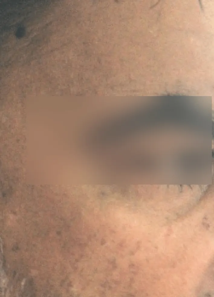 Before and after result 4 — after