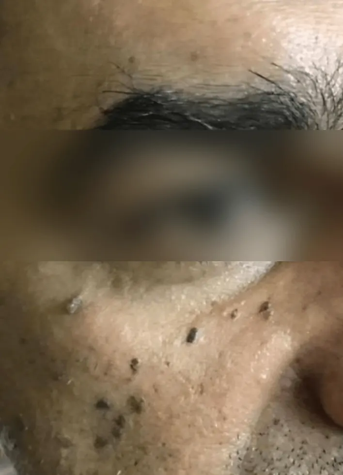 Before and after result 4 — before