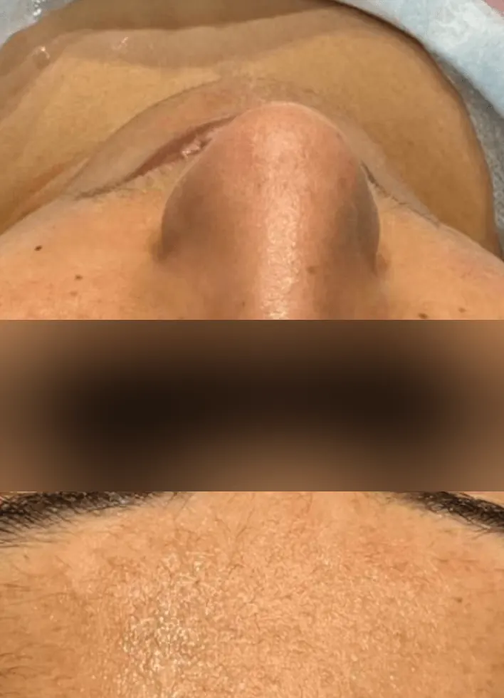 Before and after result 5 — after