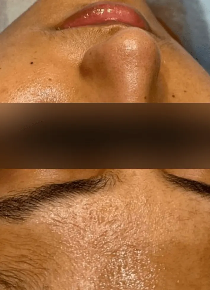 Before and after result 5 — before